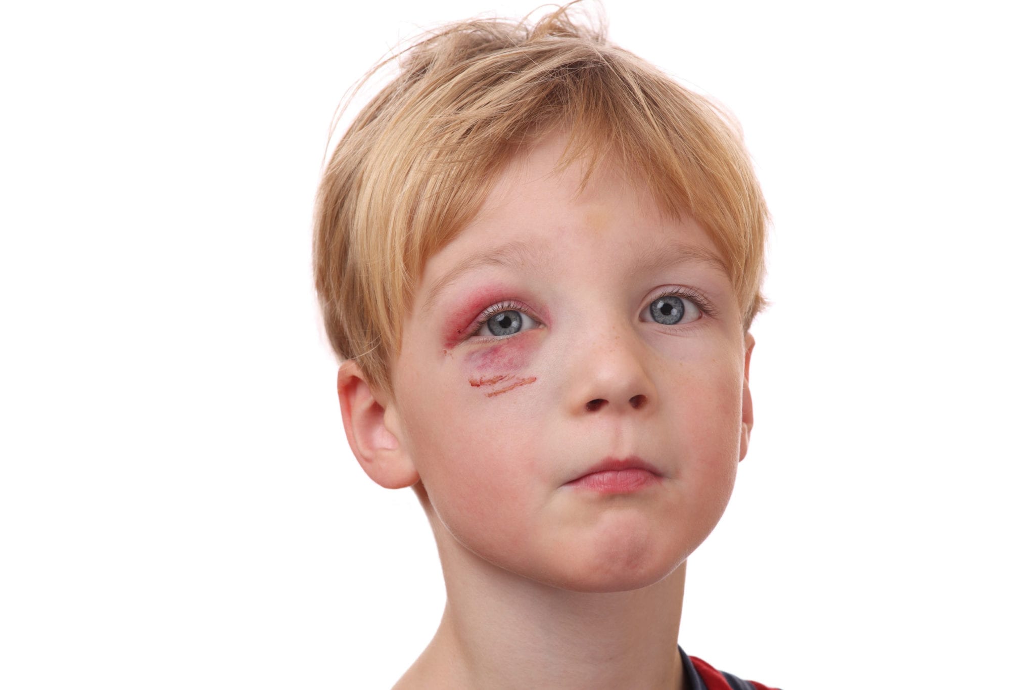  Injury to a Child Doesn't Always Indicate Abuse in Texas